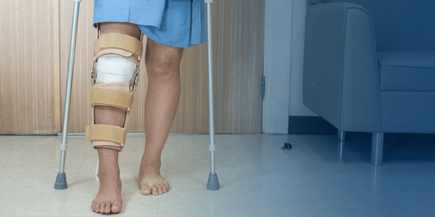 What to Expect Before and After ACL Surgery: A Comprehensive Guide - BodyICE Australia