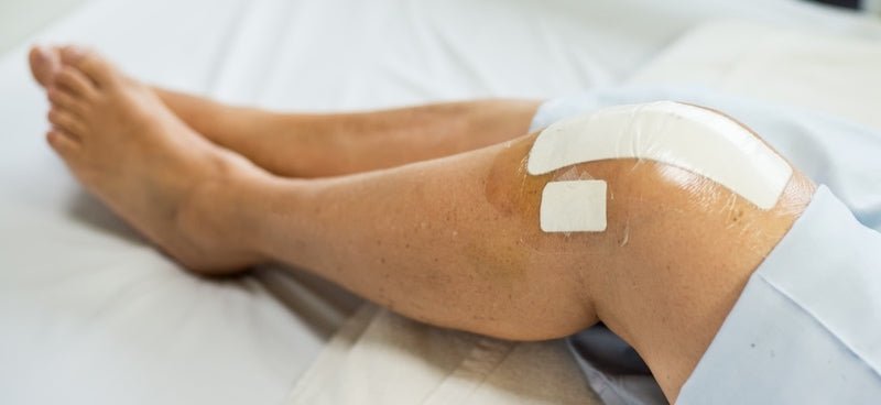 Your Post ACL Reconstruction Game Plan - BodyICE Australia