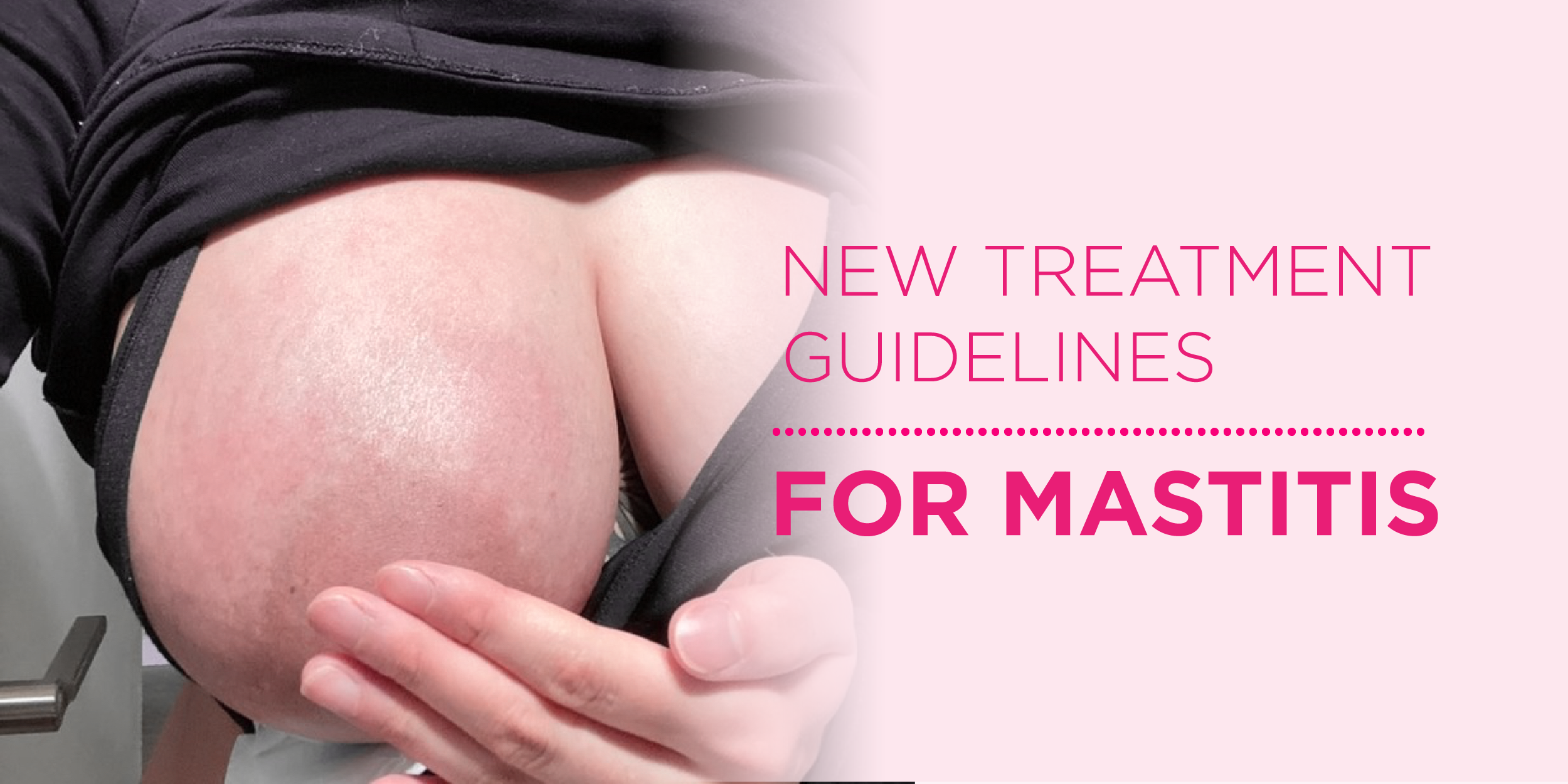 New treatment guidelines for Mastitis